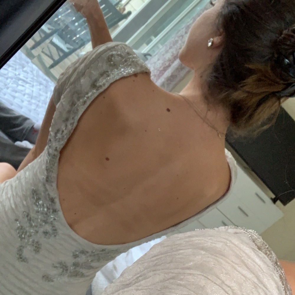 Free people open back dress